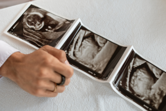 Descubra com a Dra. Thaline Neves como a ultrassonografia contribui para a medicina preventiva e promove mais qualidade de vida.