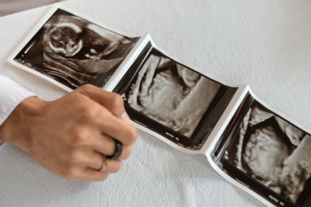 Descubra com a Dra. Thaline Neves como a ultrassonografia contribui para a medicina preventiva e promove mais qualidade de vida.