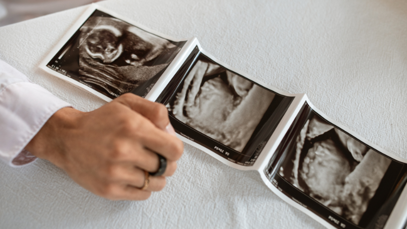 Descubra com a Dra. Thaline Neves como a ultrassonografia contribui para a medicina preventiva e promove mais qualidade de vida.